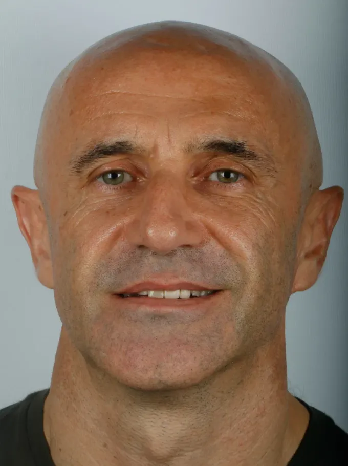 Antes: Carlos Eduardo, perfil