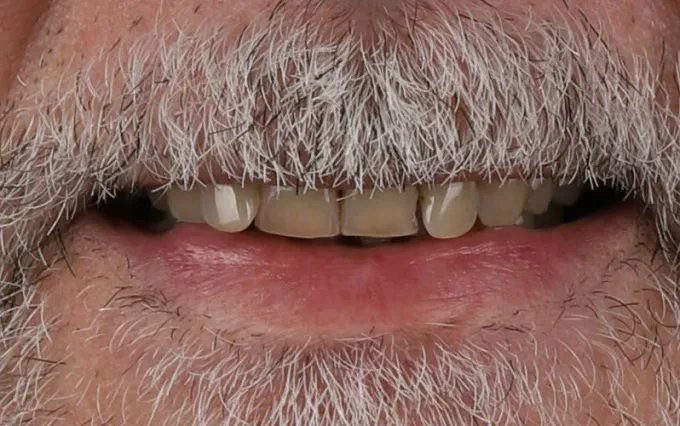 Antes: Carlos Pereira, sorriso
