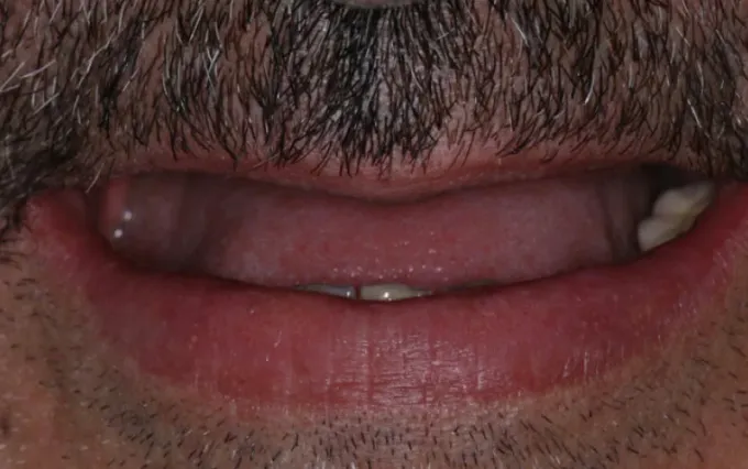 Antes: João Targino, sorriso