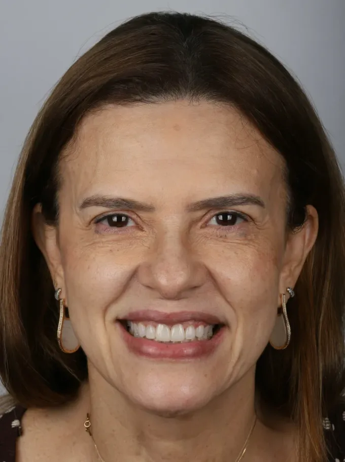 Depois: Marcia Ximenes, perfil