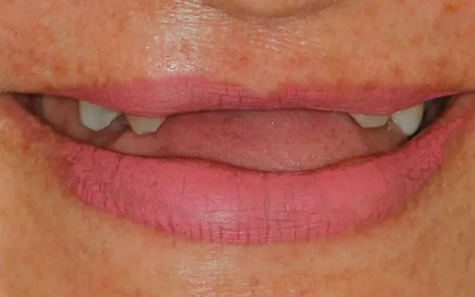 Antes: Maria Senhora, sorriso