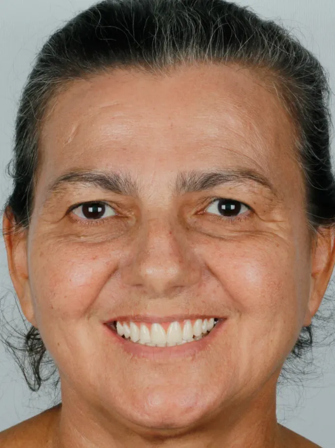 Antes: Suzana Targino, perfil