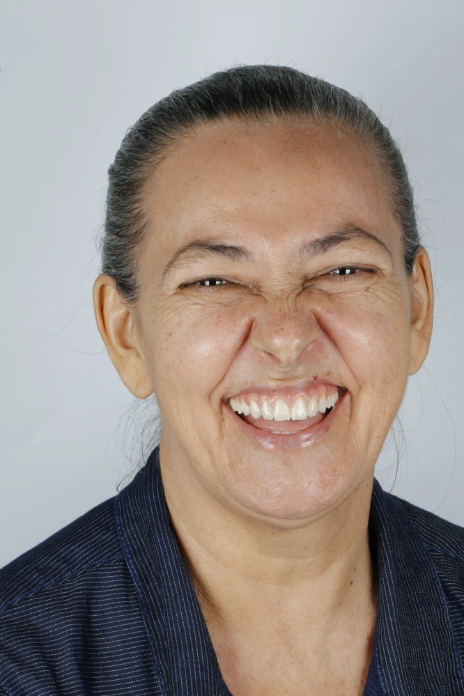 paciente_senhora-cabelo-grisalho-camisa-listrada-sorriso-largo-fundo-branco-rotacionada_13-zpc